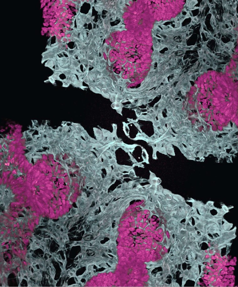 Cincinnati Children’s Research (@cincyresearch) on Twitter photo <a href="/MingxiaGu/">Mingxia Gu</a> <a href="/CellCellPress/">Cell</a> <a href="/CuSTOM_CCHMC/">CuSTOM</a> <a href="/UCLAstemcell/">UCLA Broad Stem Cell</a> Read more at our Research Horizons science blog: scienceblog.cincinnatichildrens.org/first-lung-org… <a href="/MingxiaGu/">Mingxia Gu</a> <a href="/CellCellPress/">Cell</a> <a href="/CuSTOM_CCHMC/">CuSTOM</a> <a href="/UCLAstemcell/">UCLA Broad Stem Cell</a> Read more at our Research Horizons science blog: scienceblog.cincinnatichildrens.org/first-lung-org…