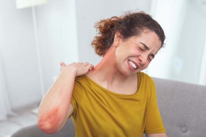 infoalergico's tweet photo. Aumentan los casos de anafilaxia en España, al tiempo que constatan su infradiagnóstico @SEAIC_Alergia 
https://t.co/bMS0b5TJmM
#alergias #alergiasalimentarias #alergiaalhuevo #sinalergias #trucosalergia #alegriayalergia #antialergicos https://t.co/WKAB2Skvnt