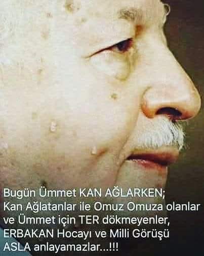 Bugün Ümmet  kan ağlarken 
Kan Ağlatanlarla omuz omuza olanlar
ve  ÜMMET için  TER dökmeyenler 
ERBAKAN  hocayı VE  MİLLİ  GÖRÜŞÜ 
_________ASLA  ANLAYAMAZLAR__________