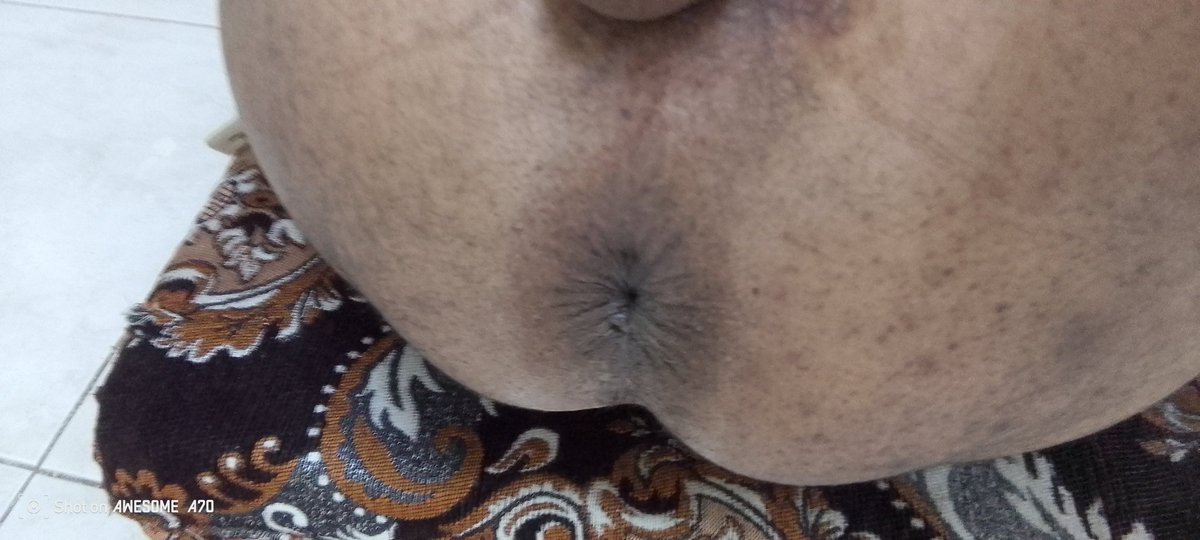 slabasmar44's tweet photo. سالب اسمر مفتوح 🔥الدرب عمري40 وزني 60 طولي 165 اللي  موجب من الدرب جاد ونحيف وزنه تحت 60  من الدرب او زاير الدرب حياه 🔥 https://t.co/w609KMeFxc