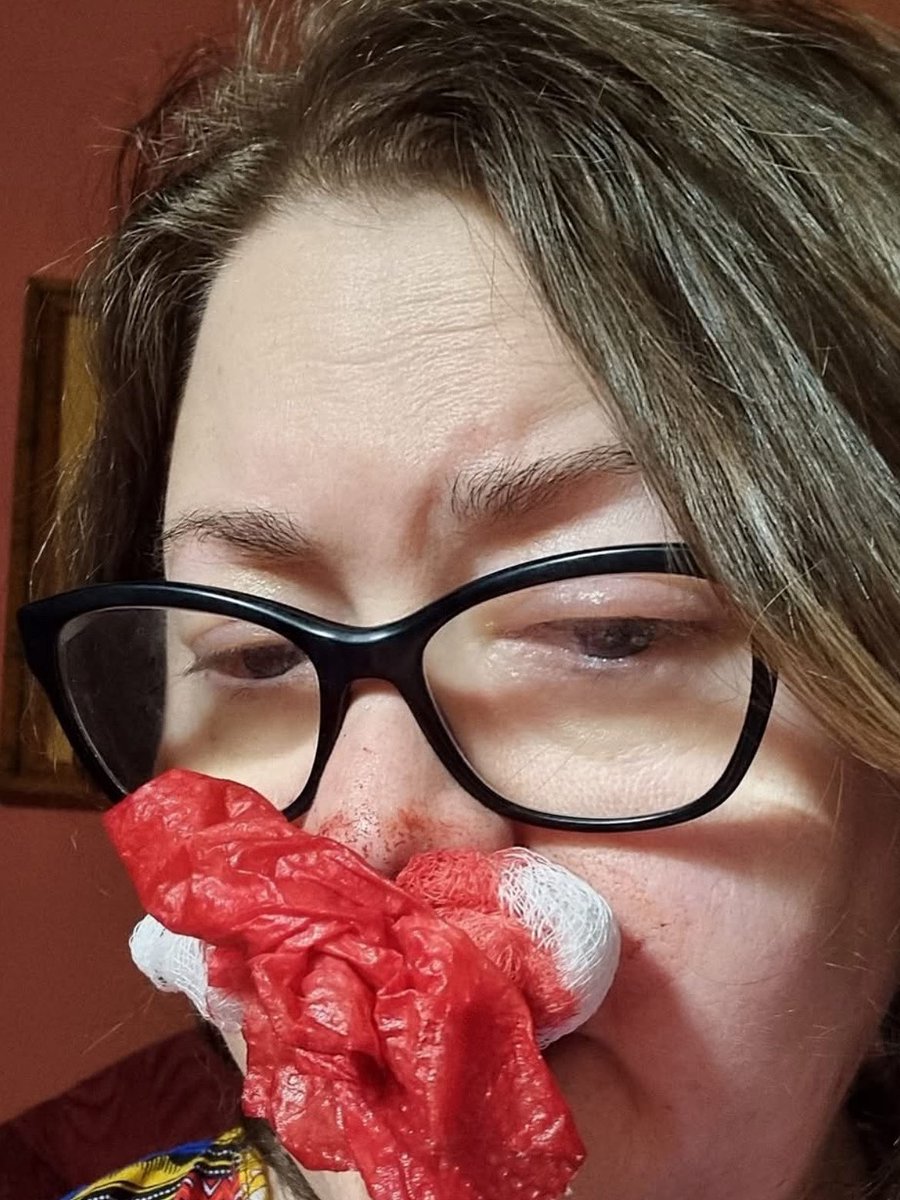 QueenBeeDetroit's tweet photo. Cathy is home from the hospital. But today, her nose is bleeding profusely, but she is unable to go back to the hospital without money.  Anything you donate, or even a prayer would be greatly appreciated right now!https://t.co/WVJn2GUlfT https://t.co/svw1KmrWTN