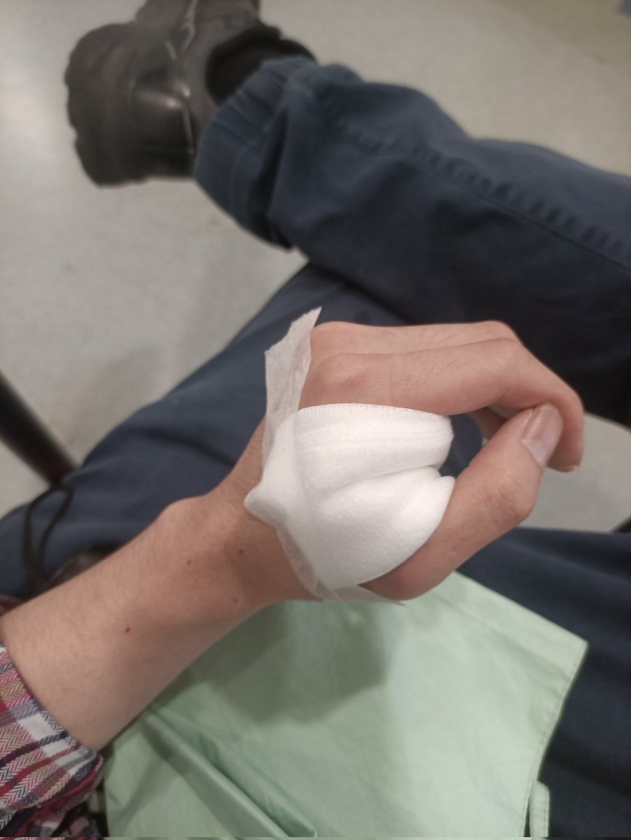justin_liu2's tweet photo. No Cooper update tonight, a tiny accident happened while I was scraping working with a scraper. I'm fine https://t.co/MQEVGXIPaA