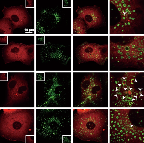 Pancreatic Cell News (@pancreaticcell) on Twitter photo ✅ Check out this new <a href="/sigtrans_sttt/">Signal Transduction and Targeted Therapy(STTT)</a> article!
Scientists elucidate a novel STYK1-driven mechanism for Wnt/β-catenin activation in APC-independent #PancreaticCancer.
go.nature.com/4lxyPJV ✅ Check out this new <a href="/sigtrans_sttt/">Signal Transduction and Targeted Therapy(STTT)</a> article!
Scientists elucidate a novel STYK1-driven mechanism for Wnt/β-catenin activation in APC-independent #PancreaticCancer.
go.nature.com/4lxyPJV
