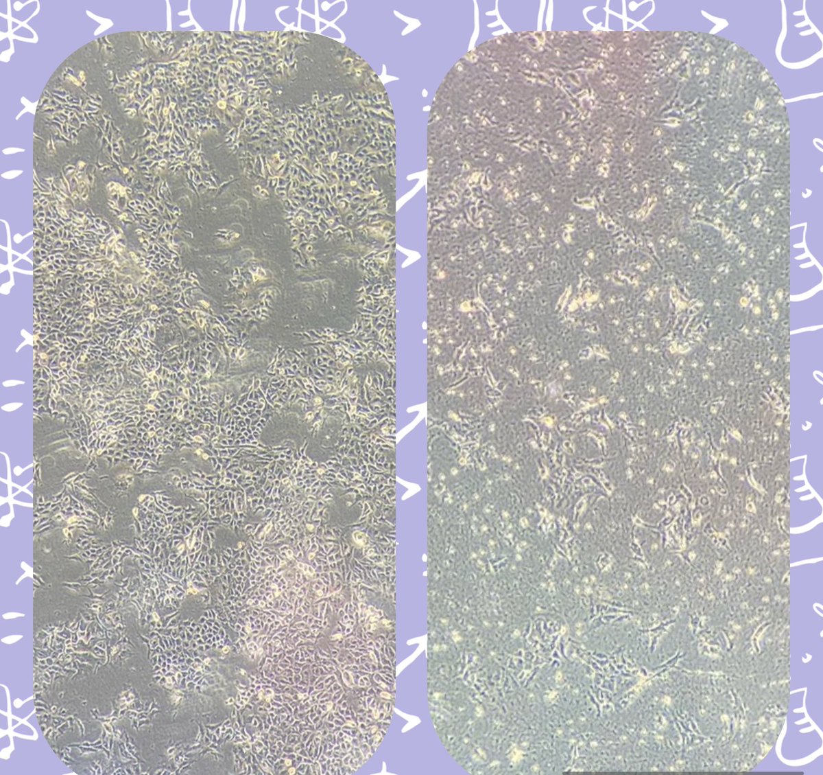 🔥 Our T cell cultures are not just surviving — they’re killing in highly specific ways! Thrilled to see robust activity and gearing up for even more sophisticated experiments. #Immunotherapy #CancerResearch #Tcells