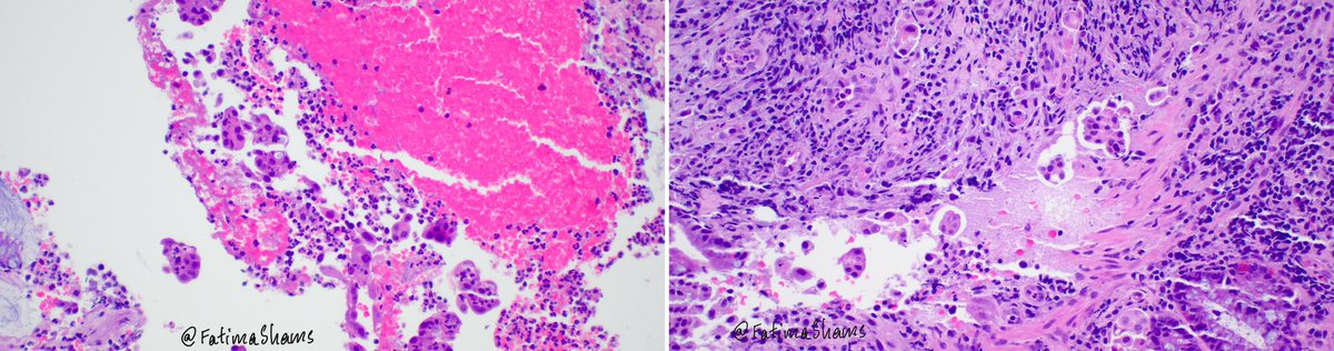 Fatima Shamsuddin tweet media