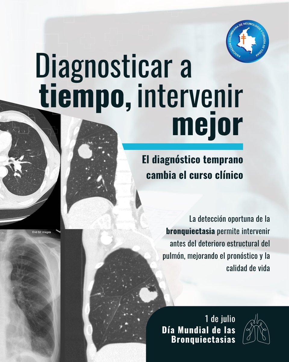Un diagnóstico oportuno puede evitar el deterioro pulmonar irreversible. Las bronquiectasias no siempre se detectan a tiempo, pero cuando lo hacemos, podemos mejorar significativamente el pronóstico.
Hoy, reafirmamos el valor de la intervención temprana.