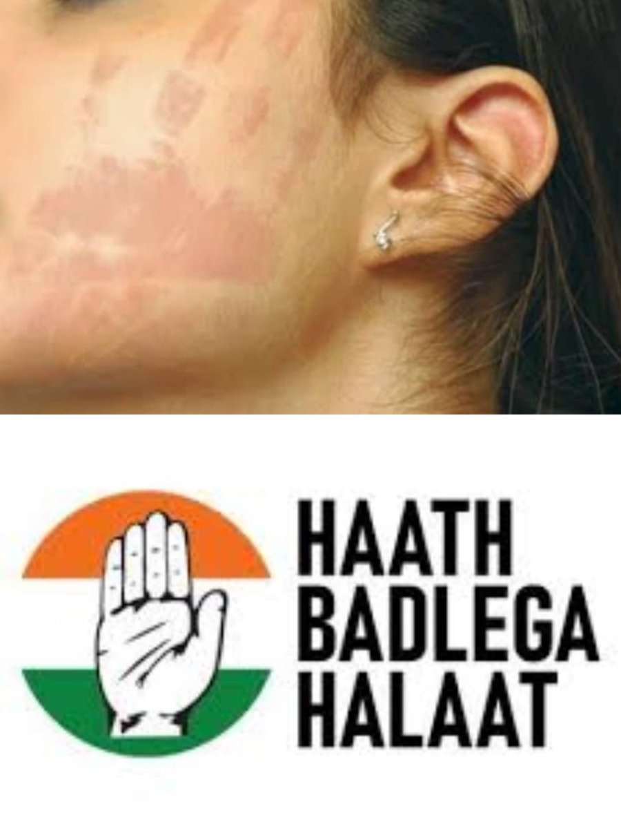 ऐसे हाथ बदलेगा हालात, तब फिर रहने ही दो, कभी नहीं बदलेंगे #हालात <a href="/INCIndia/">Congress</a>