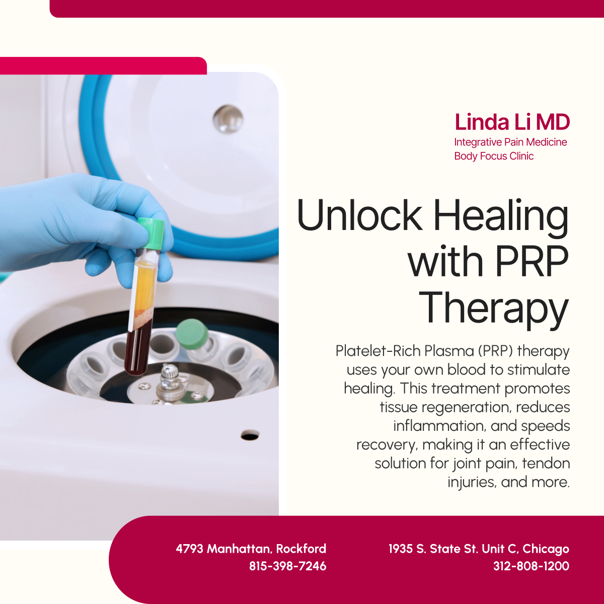 Integrativempc's tweet photo. PRP therapy harnesses your body’s natural healing power to reduce pain and accelerate recovery. Explore how this non-surgical treatment can help restore your mobility and function. 

#ChicagoIL #PRPTherapy #MedicalPainClinic https://t.co/YgK4ASyIUO