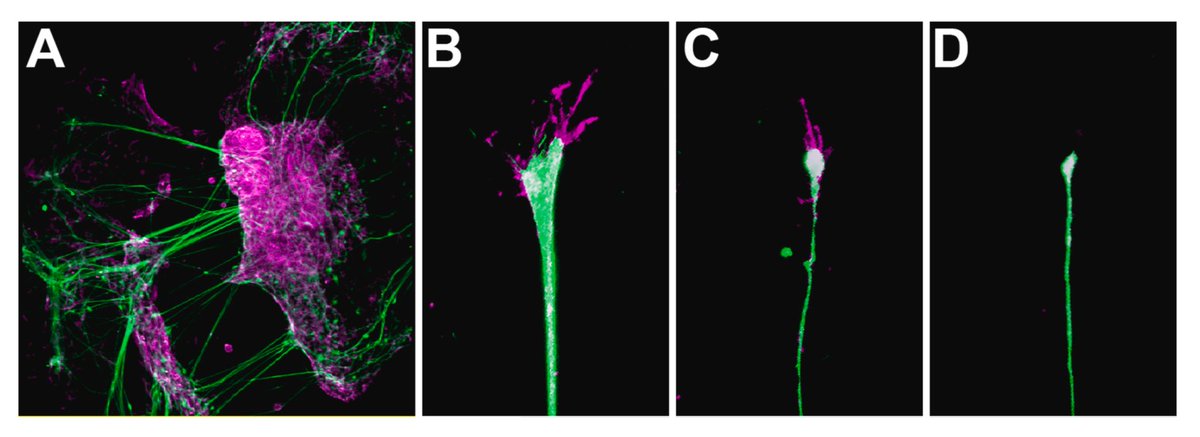 Dev_Bio_Journal's tweet image. #DBfeature #Avian🐣
Semaphorin 3A repulsion directs the caudal projection of pioneer longitudinal axons in the developing chicken brain
by Kerry-lyn Riley, Susanne Dietrich, Frank Schubert @UoPNeurodev
sciencedirect.com/science/articl…