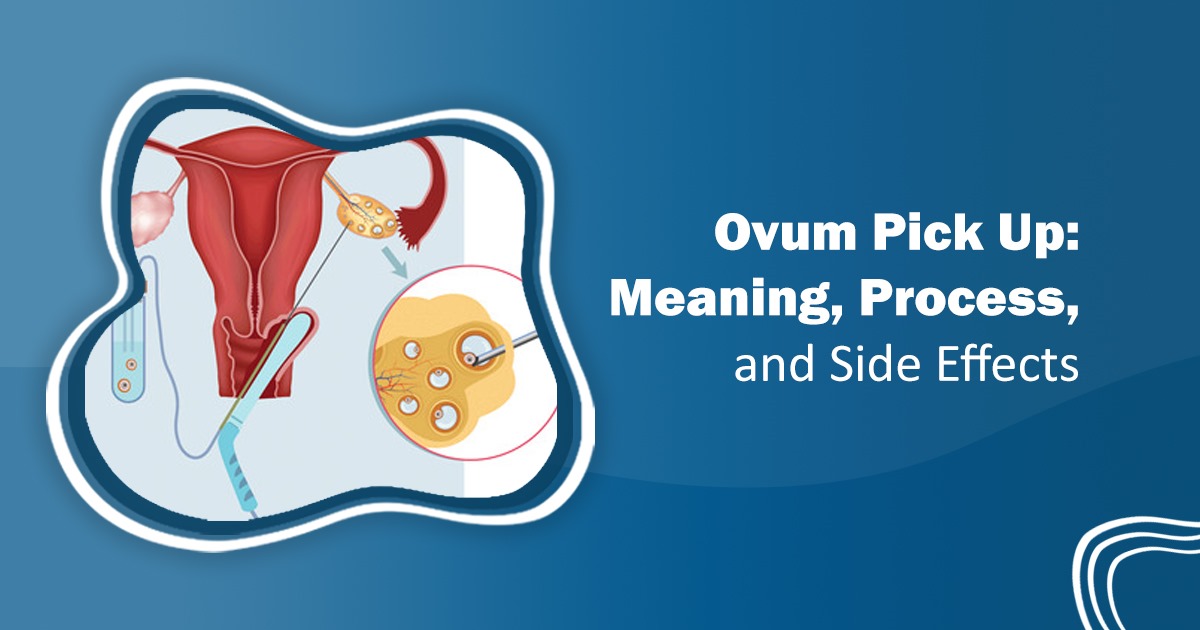 Dr. Rita Bakshi (IVF specialist) (@dr_ritabakshi) on Twitter photo What is #Ovum_Pickup (OPU)?
OPU is a key step in the #IVF_process where mature eggs are retrieved carefully from the ovaries. Learn how it’s done safely, what to expect, and how it contributes to successful embryo development.
🔗 drritabakshi.in/what-is-ovum-p…
#OvumPickUp #IVFProcess What is #Ovum_Pickup (OPU)?
OPU is a key step in the #IVF_process where mature eggs are retrieved carefully from the ovaries. Learn how it’s done safely, what to expect, and how it contributes to successful embryo development.
🔗 drritabakshi.in/what-is-ovum-p…
#OvumPickUp #IVFProcess