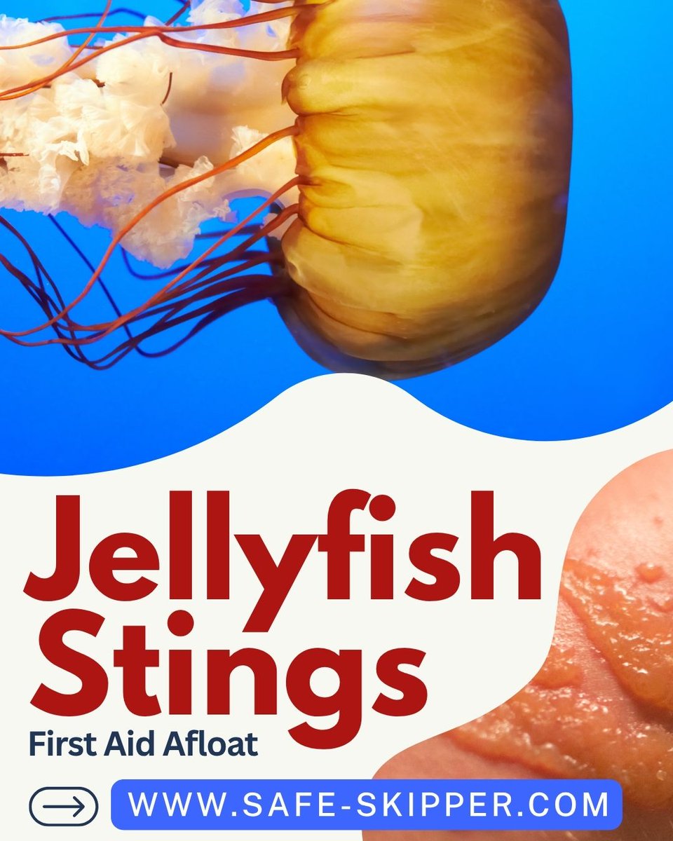 🚨Learn what to do (and what NOT to do!) for jellyfish stings, including immediate actions, specific treatments, and essential items for your boater's First Aid Kit.
Be Prepared:
🪼 safe-skipper.com/first-aid-aflo…

#JellyfishStings #sailing #boating #yachting #SafeSkipper #firstaidatsea
