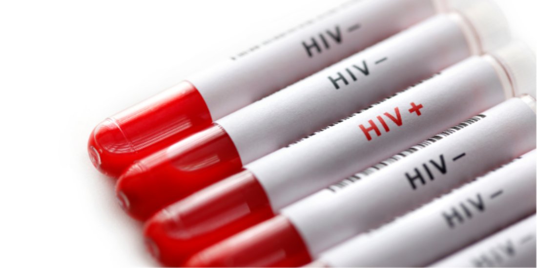 📰 Un estudi liderat per investigadors del <a href="/ceeiscat/">CEEISCAT</a> i <a href="/IDIAPJGol/">IDIAPJGol</a> revela oportunitats per reforçar el diagnòstic precoç del VIH a l'atenció primària catalana

📊 Només el 22,7% dels casos amb condicions indicatives van ser seguits d'una prova del VIH

🔗bit.ly/estudi_EuroSur…