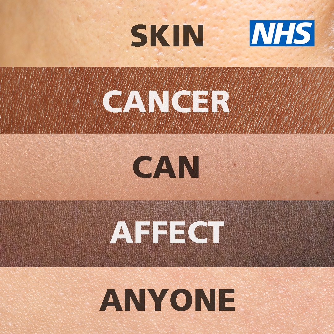 During the hot weather, remember to protect your skin from the sun, which can help reduce your chance of developing skin cancer.

Apply sunscreen and try to keep out of the sun during the hottest parts of the day.

More advice ➡️ nhs.uk/sun