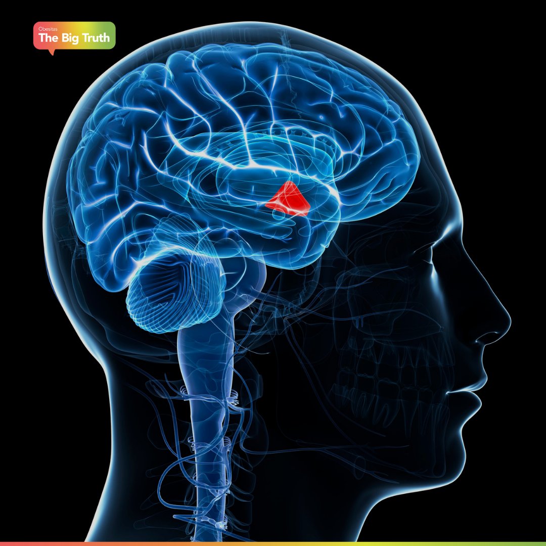 thebigtruth_eu's tweet photo. Did you know? The hypothalamus regulates weight via hormones like leptin, which signals energy reserves. In obesity, leptin resistance disrupts this signal, leading to fat storage. The body defends weight fiercely, making regulation complex.

Learn more: https://t.co/RbQi6cSF3b https://t.co/90mamtQY8f