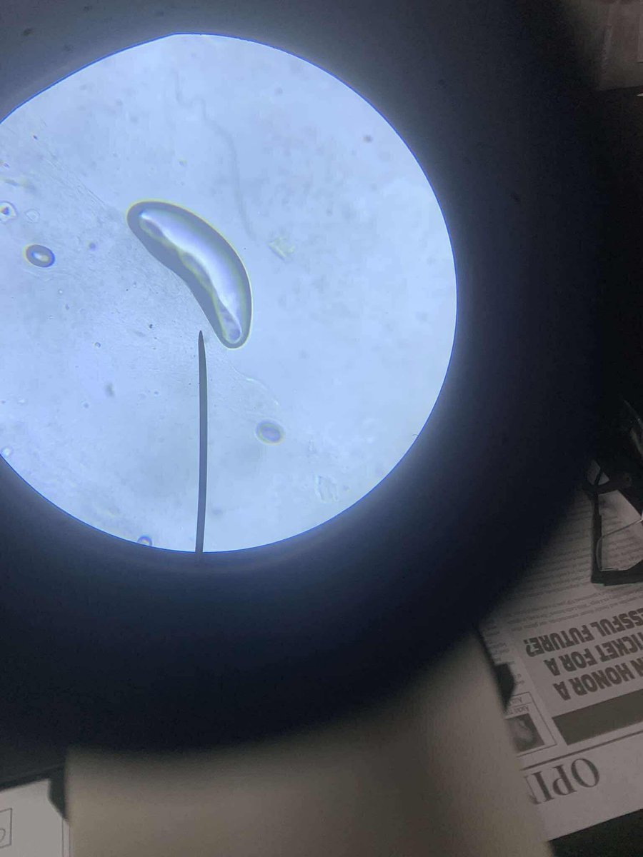 1st ever microscopy 🔬 :') 

#archivetwt!
