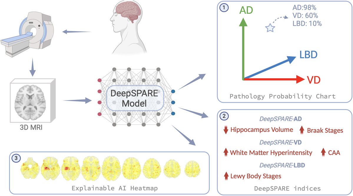 Wang et al. developed a multi-label deep learning framework to identify neuroimaging signatures for AD, vascular dementia, and LBD using antemortem MRI. The model uncovered distinct patterns of alterations associated with each pathology. tinyurl.com/c6mh9vnh