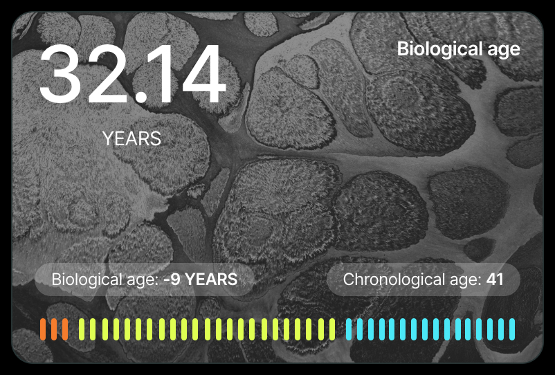 alban denoyel (@albn) on Twitter photo Just went through the <a href="/lucis_life/">Lucis (YC X25)</a> protocol which measured 78 of my biomarkers, nice to find out my biological age is 32 😎
As I get older, I'm definitely interested in better understanding and tracking my health, particularly as it feels a lot of issues could be prevented if Just went through the <a href="/lucis_life/">Lucis (YC X25)</a> protocol which measured 78 of my biomarkers, nice to find out my biological age is 32 😎
As I get older, I'm definitely interested in better understanding and tracking my health, particularly as it feels a lot of issues could be prevented if