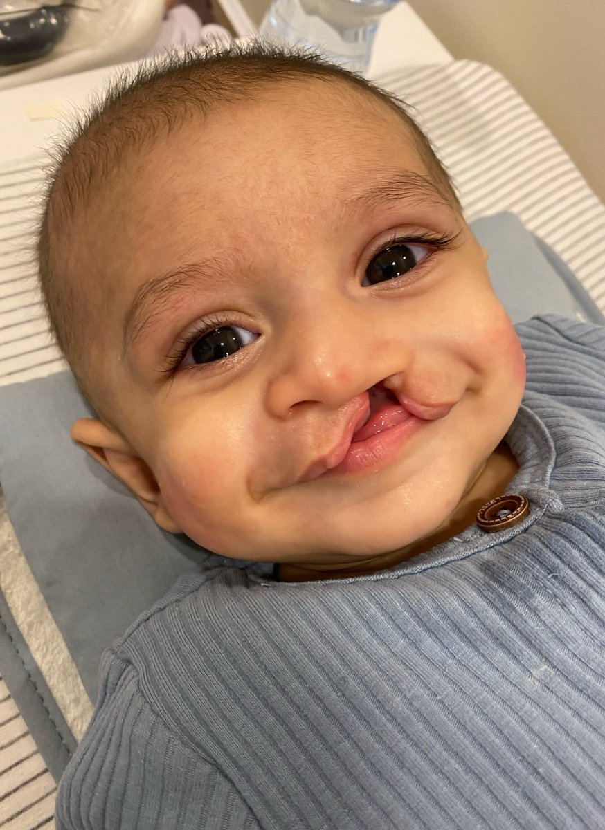 🤍 يوليـو 🤍

شهر التوعية بشقوق الفم و متلازمة الوجه و الفكين. 

أحبك و فخورة فيك يا سعود 🤍 !