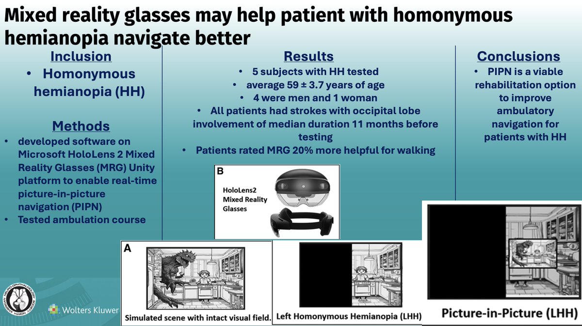 Mixed Reality Glasses with Picture-in-Picture Navigation for Patients with Homonymous JNO
Article: bit.ly/JNO_MRG_HH
#brain #eye #vision #research #Neurology #NeuroOphth #Ophthalmology #Medicine #stroke #AugmentedReality #MixedReality