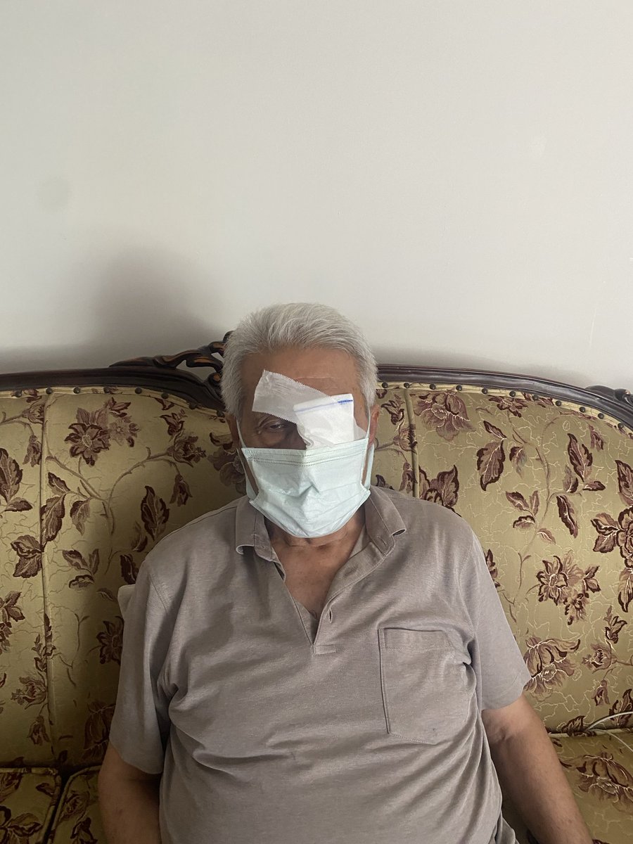 Şehir Hastanesinde ameliyatım 1.Saat sürdü evime geldim Yarın Kontrolüm Var tek gözle bunu paylaştım,Şehir Hastaneleri mükemmel Robot tekniğiyle Dr,İle birlikte ameliyat yapıyorlar Erdoğan gibi bir Başkan Bizlere nasip oldu Ona çok teşekkürler ediyorum!🇹🇷❤️