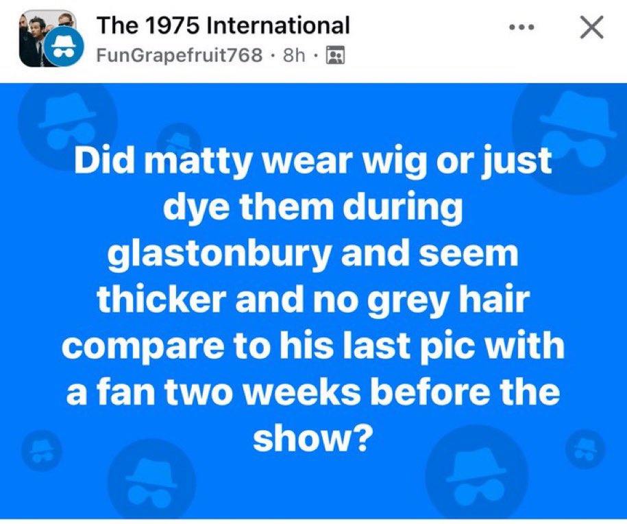 shesroadkill's tweet photo. from matty having alopecia conspiracies to wearing a wig allegations, we have come so far❤️❤️ https://t.co/PUzn4rh4Pn