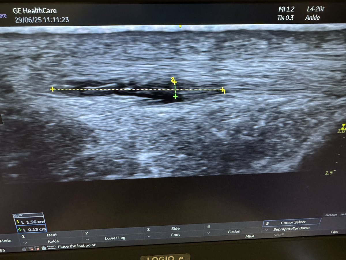 MSK Ultrasound Group tweet media