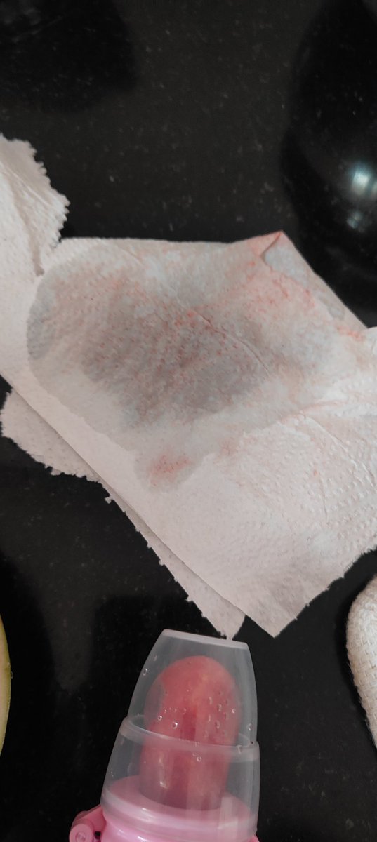 rock_swathi's tweet photo. I have ordered watermelon from the @bigbasket_com for my 6-month-old baby ( for the first time), and I got a watermelon that has been injected with chemical colour and sugar syrup, I think, but it tastes bitter..I spoke to thm and they said, sorry, will refund ur money soon 😅!!? https://t.co/ROTbW92wNc