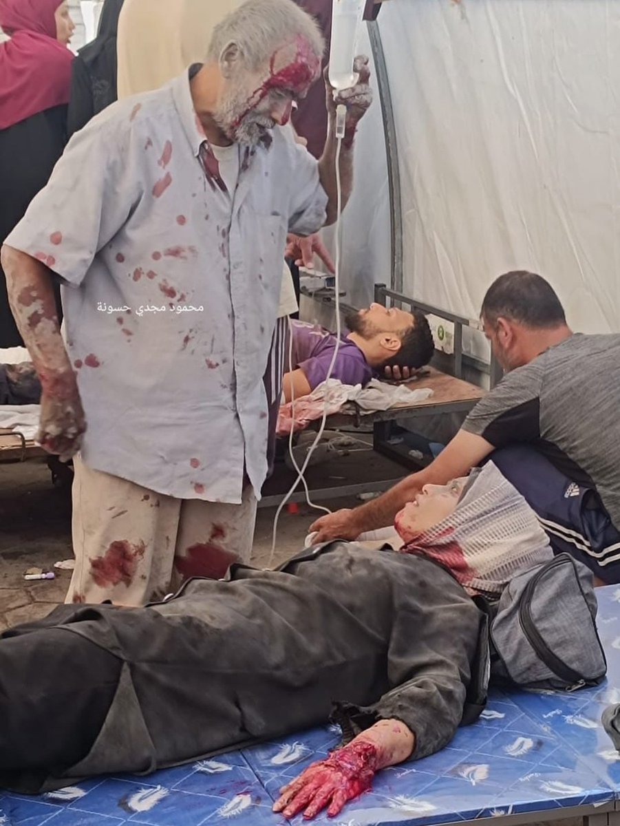 mobeid's tweet photo. مسن جريح يساعد ابنته الجريحة، هي حظيت بسرير تعالَج عليه، وهو لم يجد مكانا غير الوقوف نظرا لازدحام مستشفى المعمداني بالمصابين..ولانعدام الإمكانات حمل المسن الجريح الدواء لابنته رغم نزفه، يواسيها كي تشعر ببعض الأمان رغم انعدامه.. صورة من صور غزة حين يخفف الجريح عن الجريح. https://t.co/HRedmTXVHb