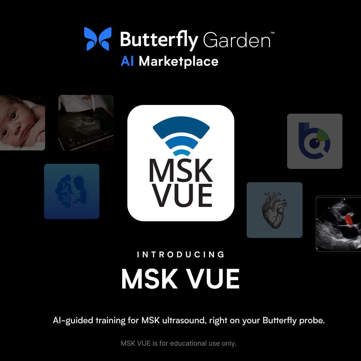 Butterfly Network (@butterflynetinc) on Twitter photo 👋 Meet MSK VUE – our newest AI-powered training tool, now in the Butterfly Garden.
Whether you're early in your career or looking to boost confidence scanning arms, elbows, and wrists, MSK VUE helps you sharpen your MSK ultrasound skills with real-time guidance. 👋 Meet MSK VUE – our newest AI-powered training tool, now in the Butterfly Garden.
Whether you're early in your career or looking to boost confidence scanning arms, elbows, and wrists, MSK VUE helps you sharpen your MSK ultrasound skills with real-time guidance.