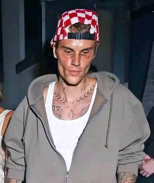 OlaOrfph's tweet photo. What is Happening to Justin Bieber? 😩😭 https://t.co/rdLPWrX3x3