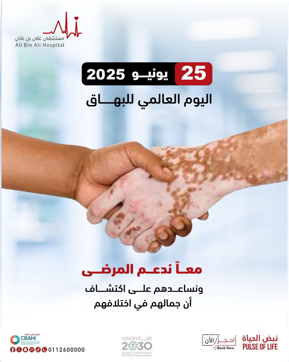 📌اليوم العالمي للبهاق يهدف لزيادة الوعي حول المرض ودعم المصابين به.
هو مرض جلدي يتسبب في ظهور بُقع يفقد فيها الجلْد لونه. وعادة ما يزيد حجم هذه البقع مع الوقت. كما قد تصيب هذه الحالة الجلد في أيِّ جزء من الجسم. 

#السعودية #مستشفى_علي_بن_علي #اليوم_العالمي_للبهاق #البهاق #جلدية