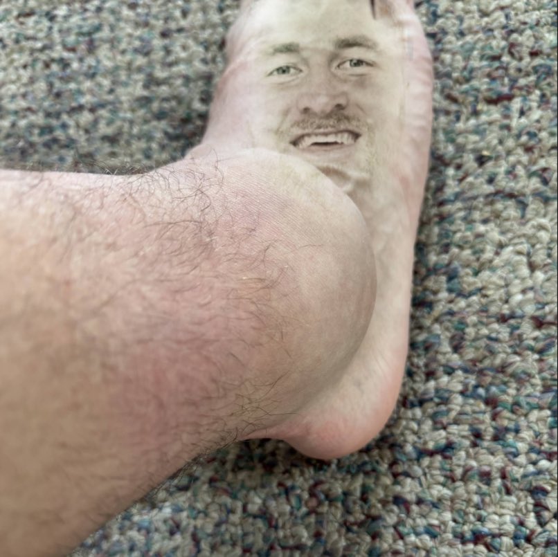 200 likes and ill make this my profile picture