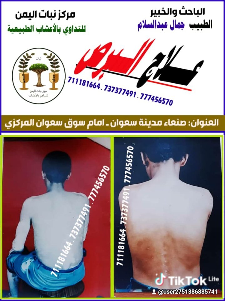 د/جمال عبد السلام الظمين (@dalslam46376) on Twitter photo 