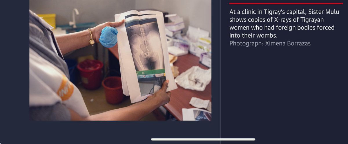 Justice4_Tigray's tweet photo. 7/15
At a clinic in Tigray’s capital, Sister Mulu shows copies of X-rays of Tigrayan women who had foreign bodies forced into their wombs.
@antonioguterres @CPG_USHMM @MinorityRight 
⬇️
Stand Up for Justice!
⬇️
#Justice4TigraysWomenAndGirls 

https://t.co/ry03yFjlez https://t.co/Jlsxb5x8nH