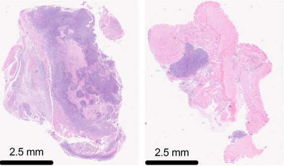 Immune_News's tweet image. 💉 Investigators described an association between mechanosensation and cross-presentation by cDC2A cells, contributing to the continued development of dendritic cell vaccines.
🔓 @jitcancer | bit.ly/45DyeBW