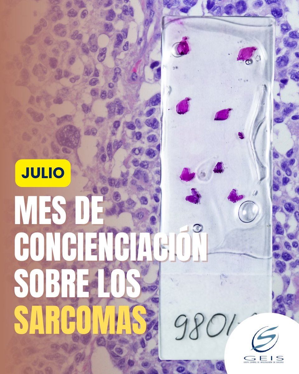 Julio es el mes de la concienciación sobre los sarcomas.

🔬 Cáncer raro que afecta huesos y tejidos blandos.

¿Cómo ayudar?
✅ Infórmate y comparte
✅ Únete a nuestras campañas
✅ Dona para impulsar la investigación

🌐 Más en nuestra web.

#MesDelSarcoma #GEIS #Fucksarcoma