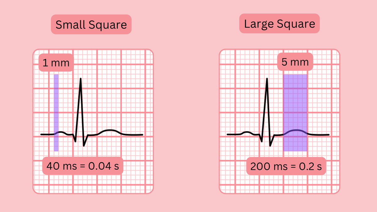ECGsmart tweet media