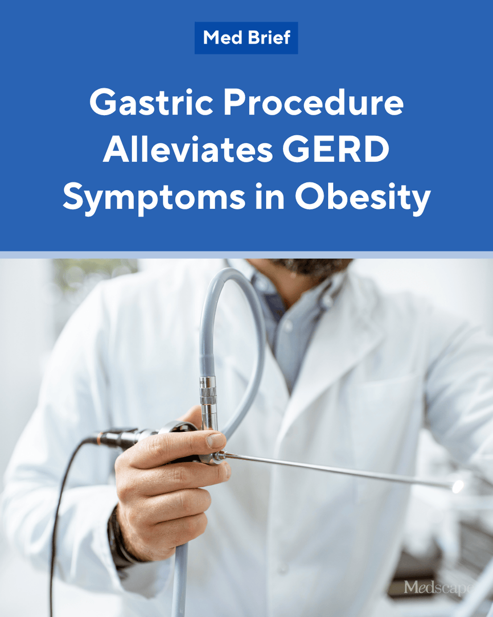 In patients with obesity, endoscopic gastric remodeling (EGR) — a minimally invasive procedure — is safe and effective in relieving both typical and atypical gastroesophageal reflux disease (GERD) symptoms at 12 months post-procedure, while also reducing proton pump inhibitor