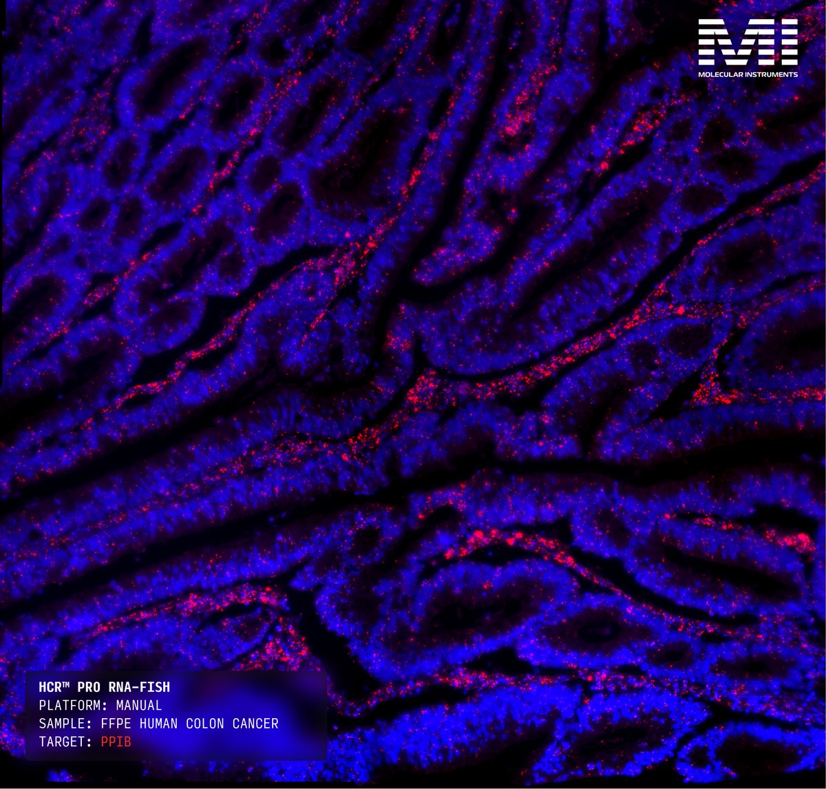 HCRimaging's tweet image. HCR™ Pro RNA-ISH for manual workflows delivers high-fidelity RNA-ISH signal across both brightfield and fluorescence detection modalities – giving you flexibility without having to buy new probes.
Brightfield: Streamline imaging and analysis with Matisse® chromogens. Ideal for…