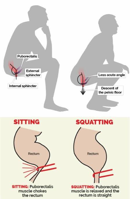 Gastronaut___'s tweet image. Squatting is a more physiological posture for defecation than sitting.
Because :
-Relaxes puborectalis → straightens rectoanal angle
-Enables faster, complete evacuation
-Reduces straining → protects pelvic nerves.