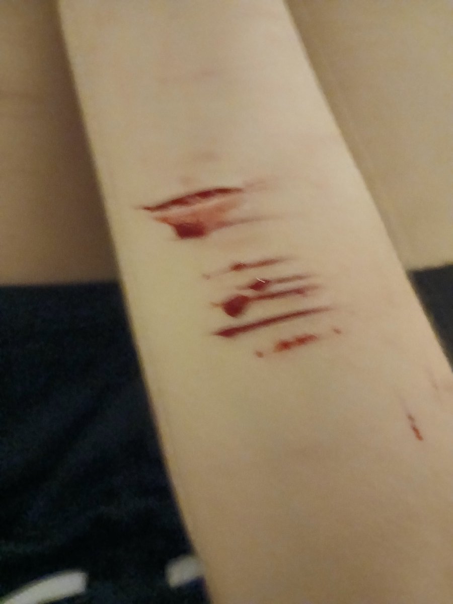 deathlyblessd's tweet photo. Small Sesh!! (Bad Quality :P) #shtwt #gore #goretwt https://t.co/HOEeoSpox9