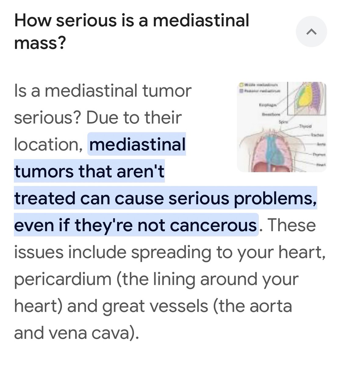 TheMadameB's tweet photo. @cockneygal1 @SelectiveHeston @DillyDongl13280 @TerryC800 @KateShemirani @BBGRichie You do understand that Paloma initially presented with a mediastinal mass which is a tumour? https://t.co/58i4oTTwxo