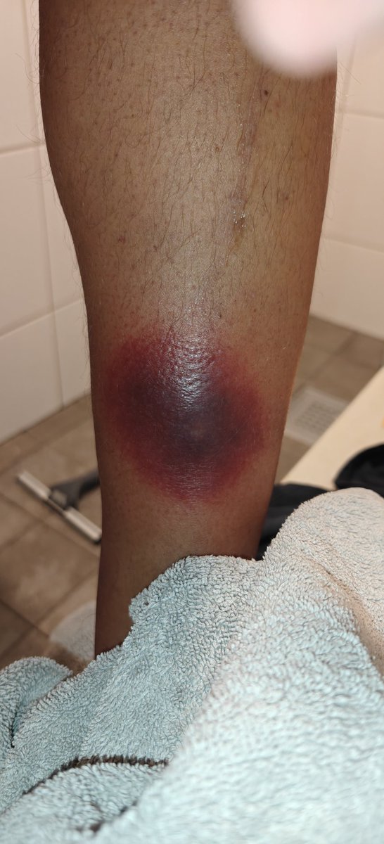 Frodda (@_frodda) on Twitter photo Aj Aj