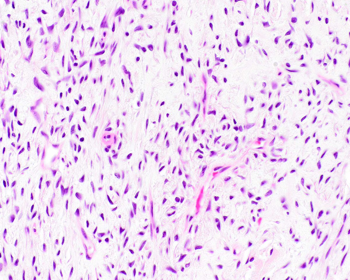 UMiami Pathology tweet media
