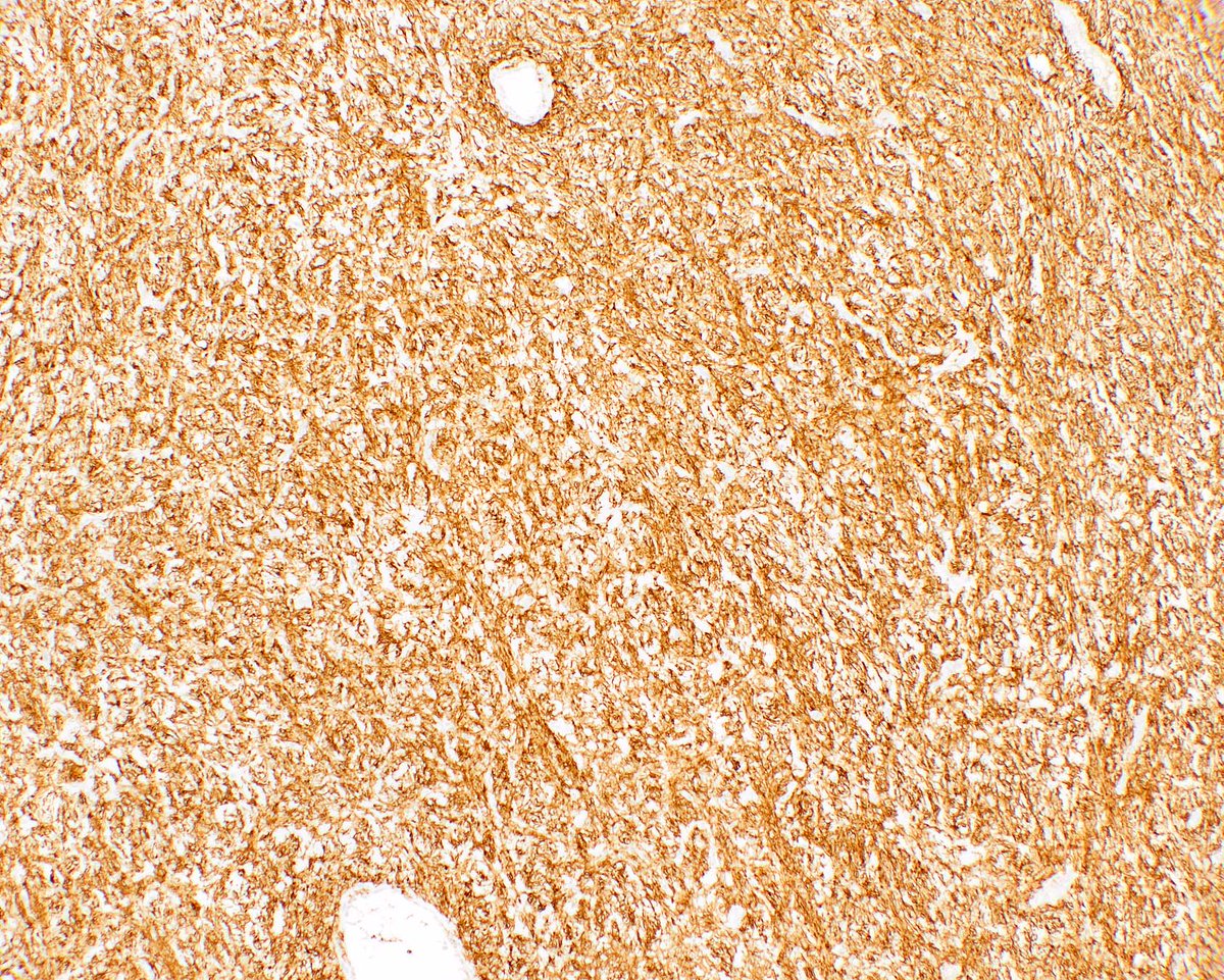 UMiami Pathology tweet media