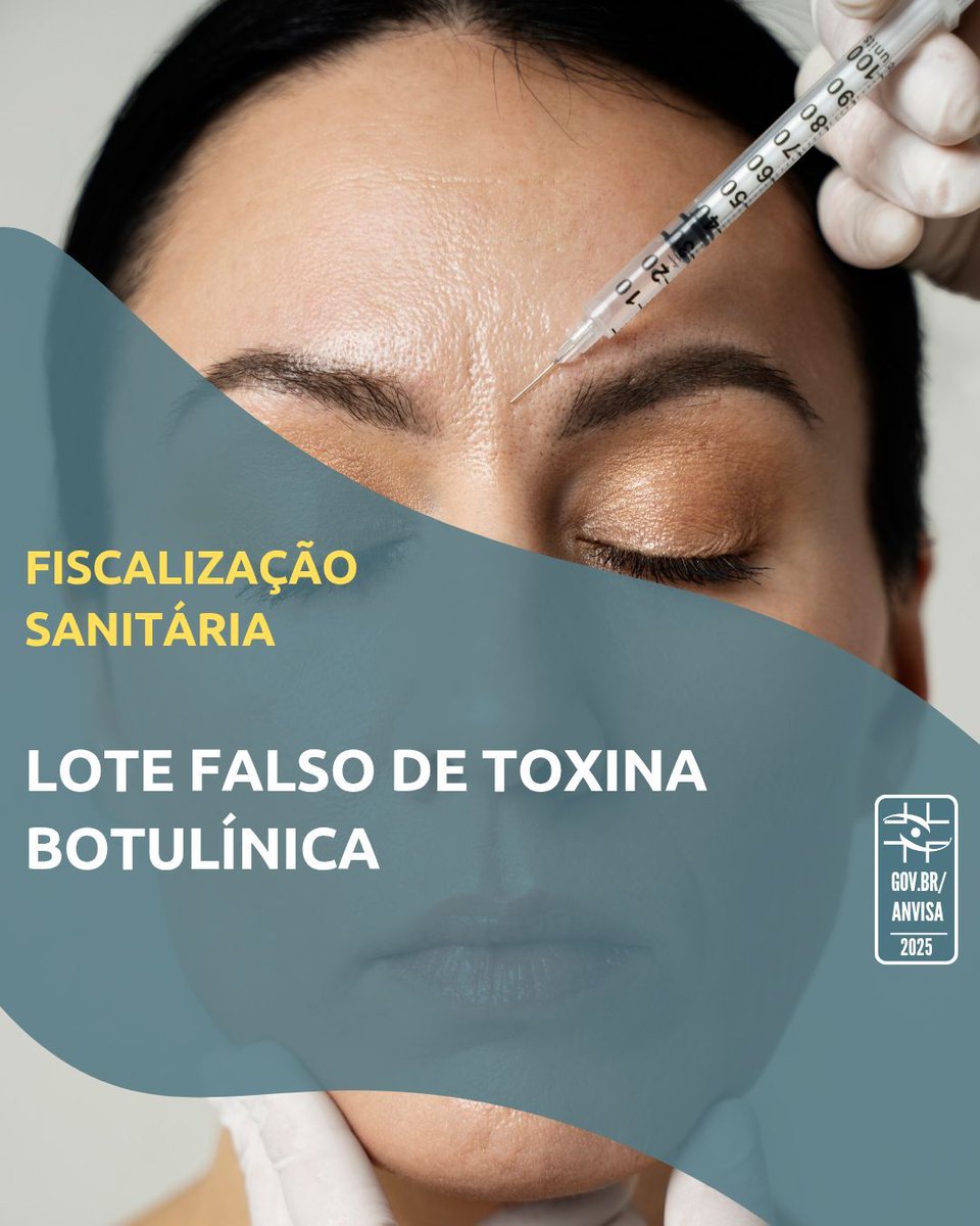 A Anvisa determinou a apreensão do lote C8846C3 do Botox® 200U (toxina botulínica A), com validade 01/08/2026. A detentora do registro, AbbVie Farmacêutica, informou ter identificado no mercado unidades com características diferentes do lote original. Saiba mais em nosso portal.