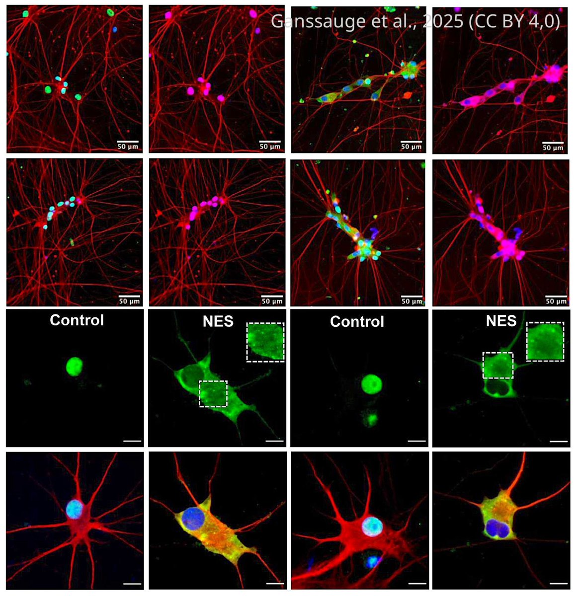🧠 May's most-read #Neuroscience paper used stem cells to model how a key protein goes rogue in #ALS: elifesciences.org/reviewed-prepr… 

Have a paper people should see? See what our Editors look for: elifesciences.org/about/aims-sco…
