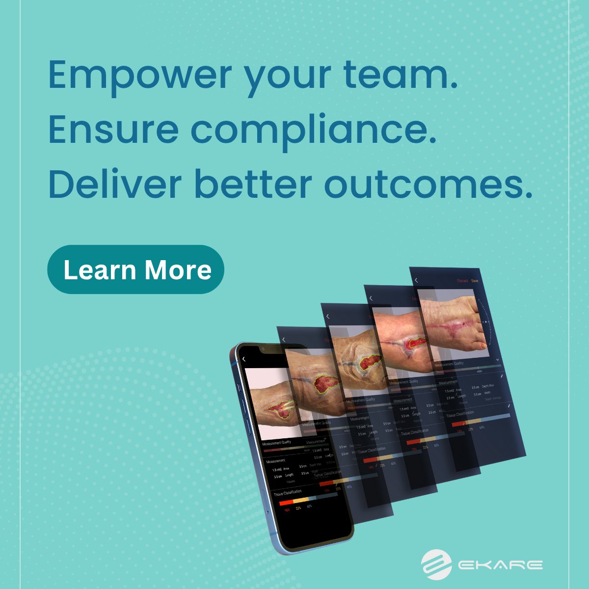 Meet inSight — the advanced digital wound management solution transforming how clinicians capture, track, and manage wound data.

✅ Automated wound measurements
✅ Structured documentation
✅ Audit-ready reports
✅ Improved clinical compliance