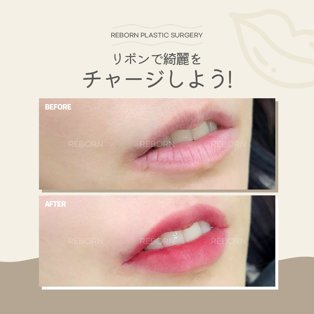 reborn_ps's tweet photo. くすみのない、ふっくらとした唇に変身！
リボン���ップアートメイクで、
自然な血色感を引き出し、魅力的な口元を手に入れましょう💋💕

✔ メイクなしでもキレイな唇
✔ 毎日の手間が省けてラクラク！
✔ ナチュラルな色味でどんなシーンにもぴったり！

🆔 @701ivtxh

#アートメイク #リップメイク #リップアートメイク #韓国メイク #アートメイク
