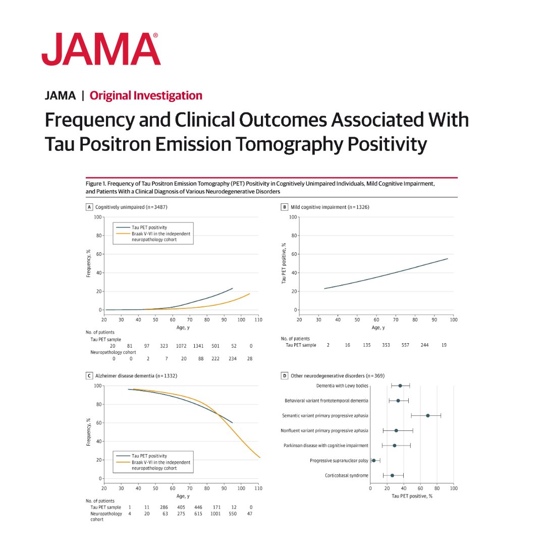 JAMA (@jama_current) on Twitter photo Tau PET positivity is detectable in a small but nonnegligible proportion of individuals in the preclinical stages of #Alzheimer disease, with increasing frequency in symptomatic stages of the disease.
ja.ma/40n4UMC <a href="/CambridgeFTD/">Cambridge FTD</a> Tau PET positivity is detectable in a small but nonnegligible proportion of individuals in the preclinical stages of #Alzheimer disease, with increasing frequency in symptomatic stages of the disease.
ja.ma/40n4UMC <a href="/CambridgeFTD/">Cambridge FTD</a>